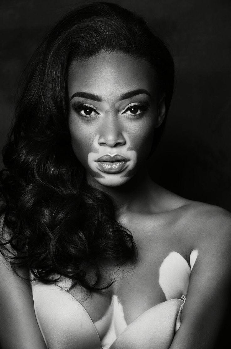 46 best Winnie Harlow image