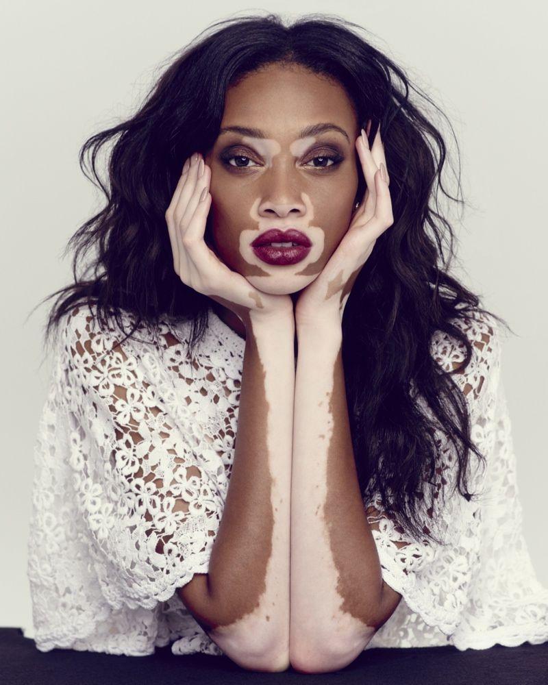 Winnie Harlow Photos: Her Campaigns for Desigual & Diesel