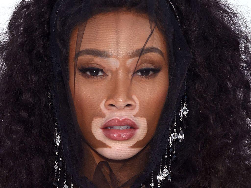 Winnie Harlow: ‘It’s Beautiful That the Age of Cookie