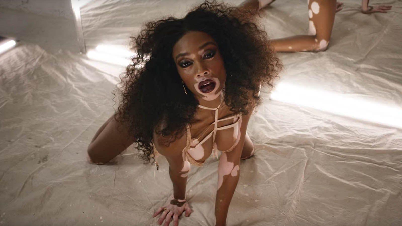 LOVE Advent Calendar Day 15: Winnie Harlow