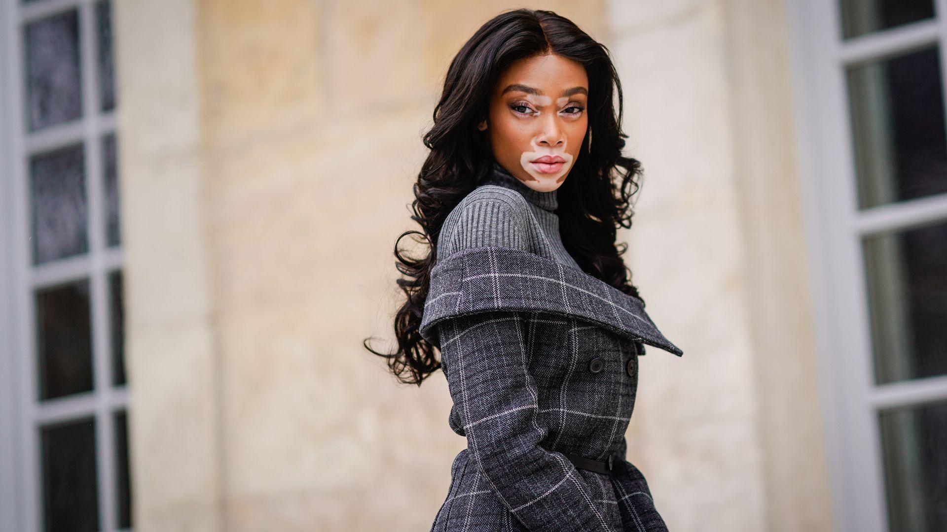 Winnie Harlow Slams Magazine for Vitiligo Comment