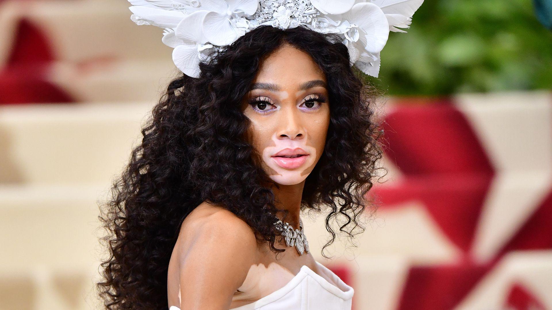 Winnie Harlow Disses ‘America’s Next Top Model’