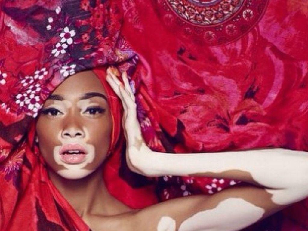 Rencontre avec Winnie Harlow, égérie de Desigual pendant la fashion