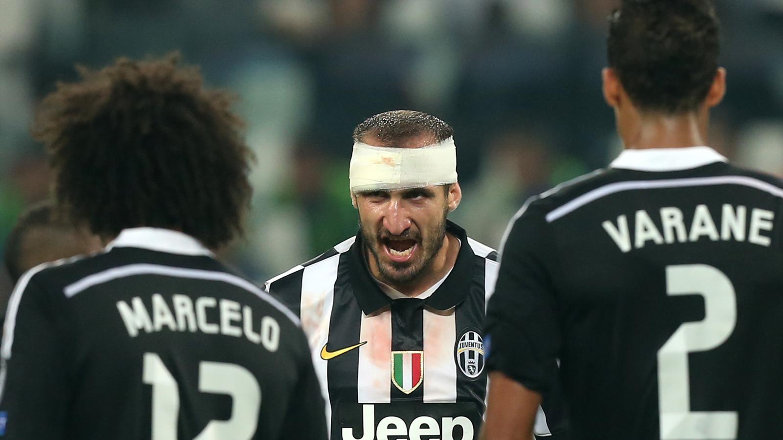 PsBattle: Giorgio Chiellini in yesterday’s game betwen Juventus